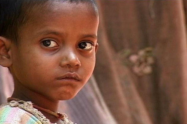6611pcindiankidsshowabnormalsugarlevelinbody:study